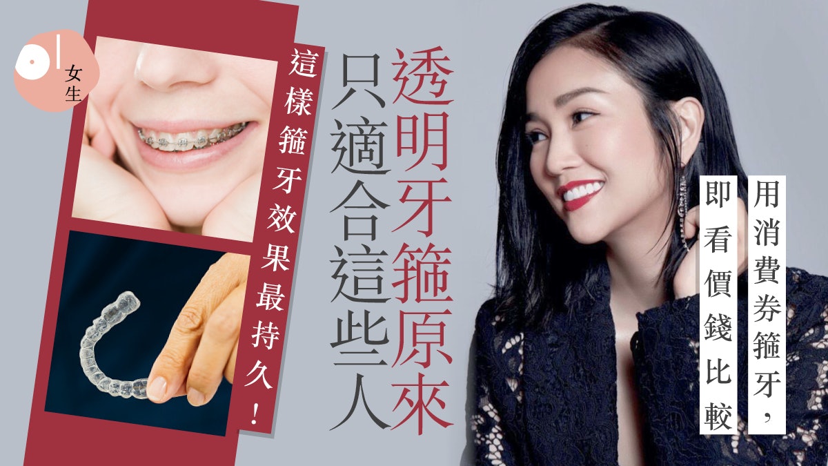 箍牙2023│4大箍牙療程價錢比較透明牙箍、傳統牙箍、陶瓷牙箍 箍牙2023│4大箍牙療程價錢比較透明牙箍、傳統牙箍、陶瓷牙箍