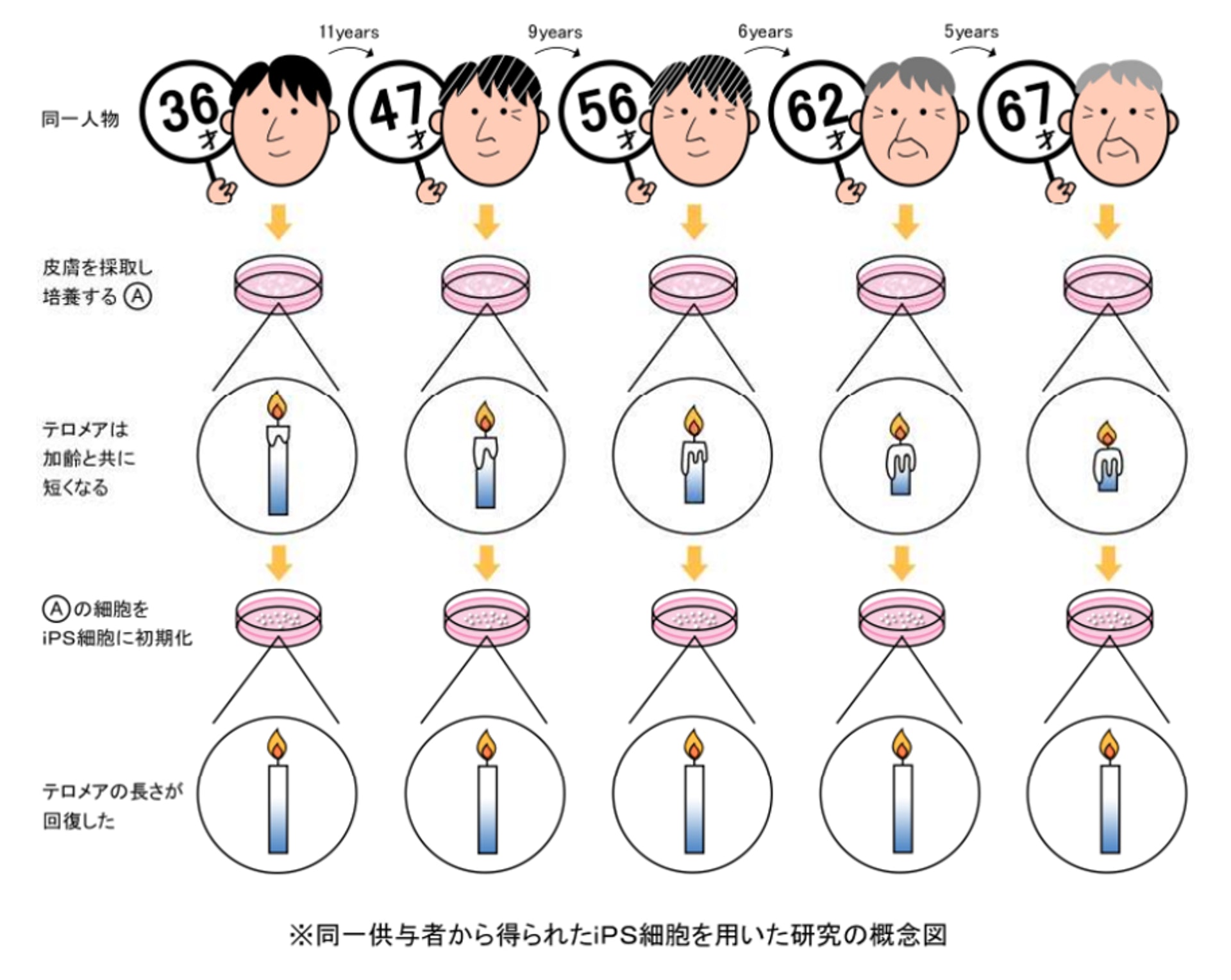 經30多年追蹤同一對象，抽取其皮膚細胞，發現iPS細胞有效令一名67歲男性的皮膚細胞能力回復到等同36歲時的狀態。（KOSE）