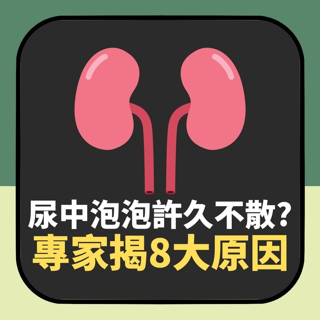 尿液泡泡長久不散8大原因　這情況要去腎臟科檢查（01製圖）