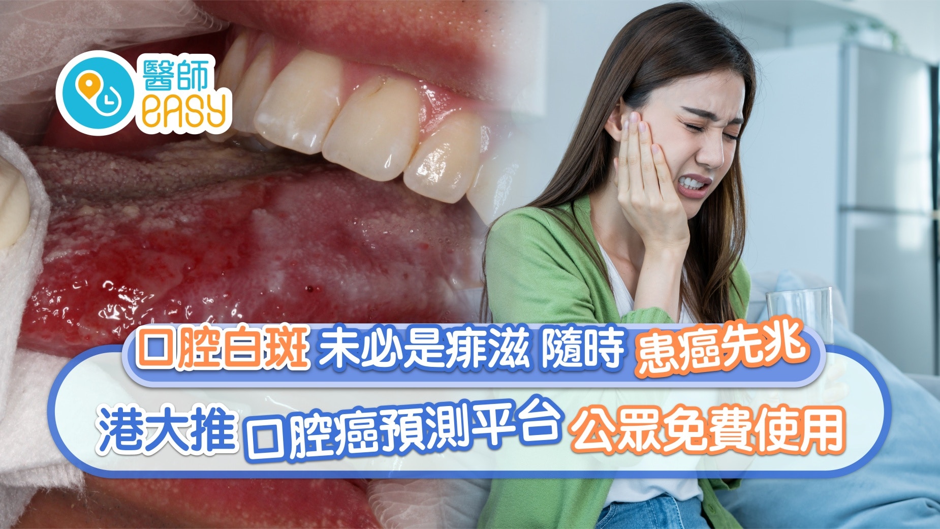 口腔癌|口腔白斑等如生痱滋? 港大推口腔癌預測平台公眾免費使用