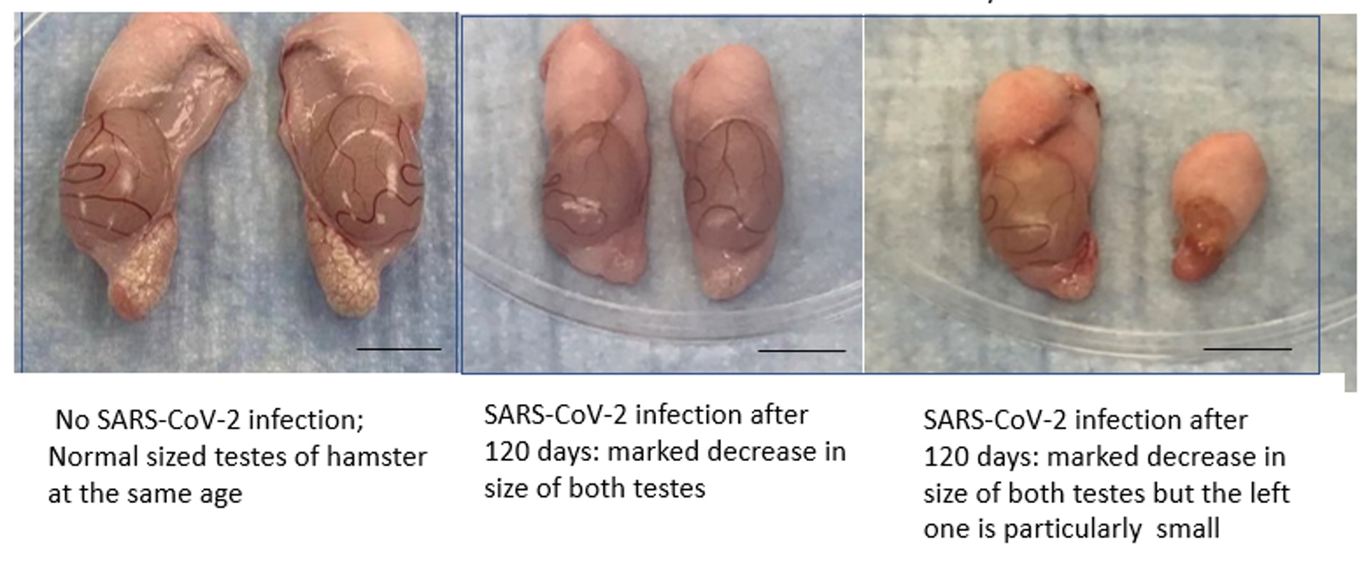 港大早前研究發現，倉鼠即使被中量的新冠病毒 （SARS-CoV-2）感染，也會出現慢性睪丸萎縮情況。圖為倉鼠感染後120日，有機會兩粒睪丸同時萎縮以及出現不同萎縮程度而導致一大一小的情況。（港大提供）