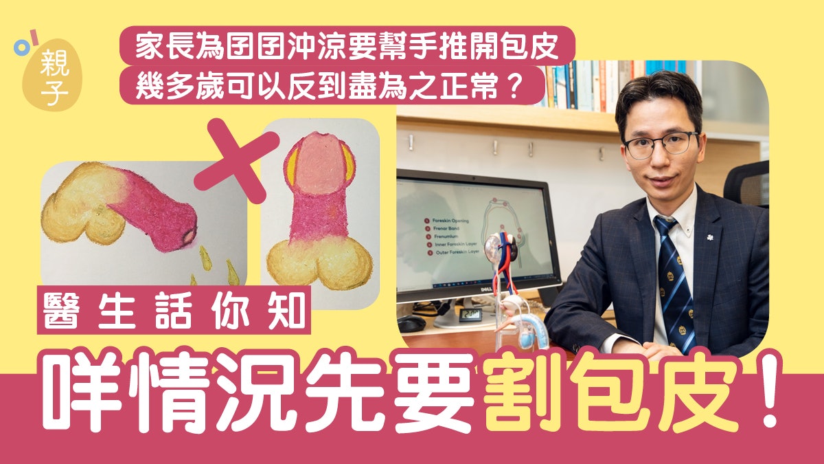 甚麼情況下要割包皮?醫生建議家長為囝囝沖涼時要幫手做一件事 甚麼情況下要割包皮?醫生建議家長為囝囝沖涼時要幫手做一件事