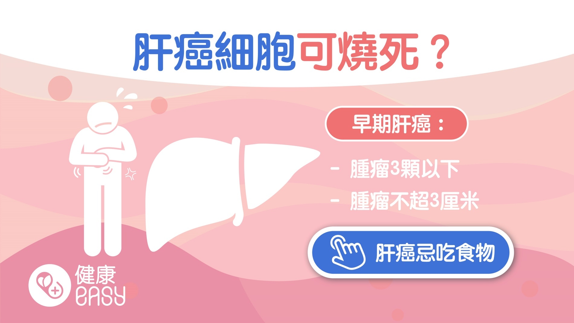 肝癌｜早期肝癌該如何治療？合乎2大條件可以電燒治療增存活機率