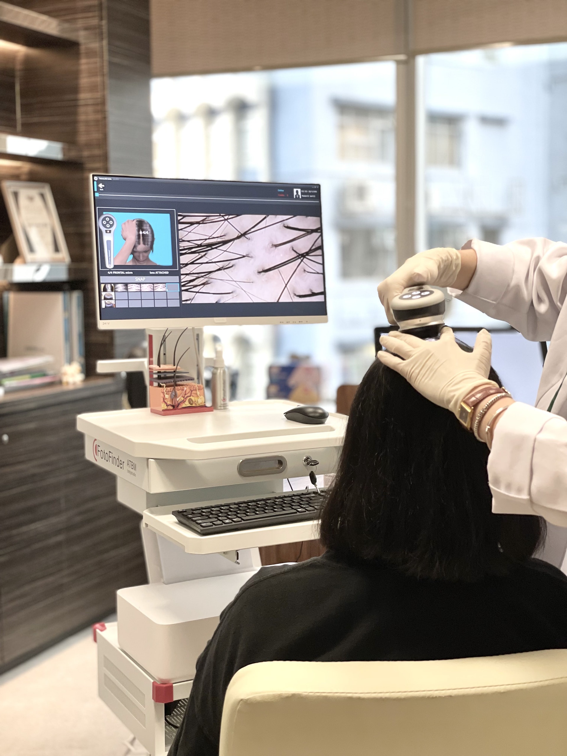 醫學科技日新月異，透過人工智能進行頭皮分析的技術，能提供客觀的科學數值和分析，找出脫髮的成因，從而制定最合適的針對性活髮療程。（圖片：fotofinder）