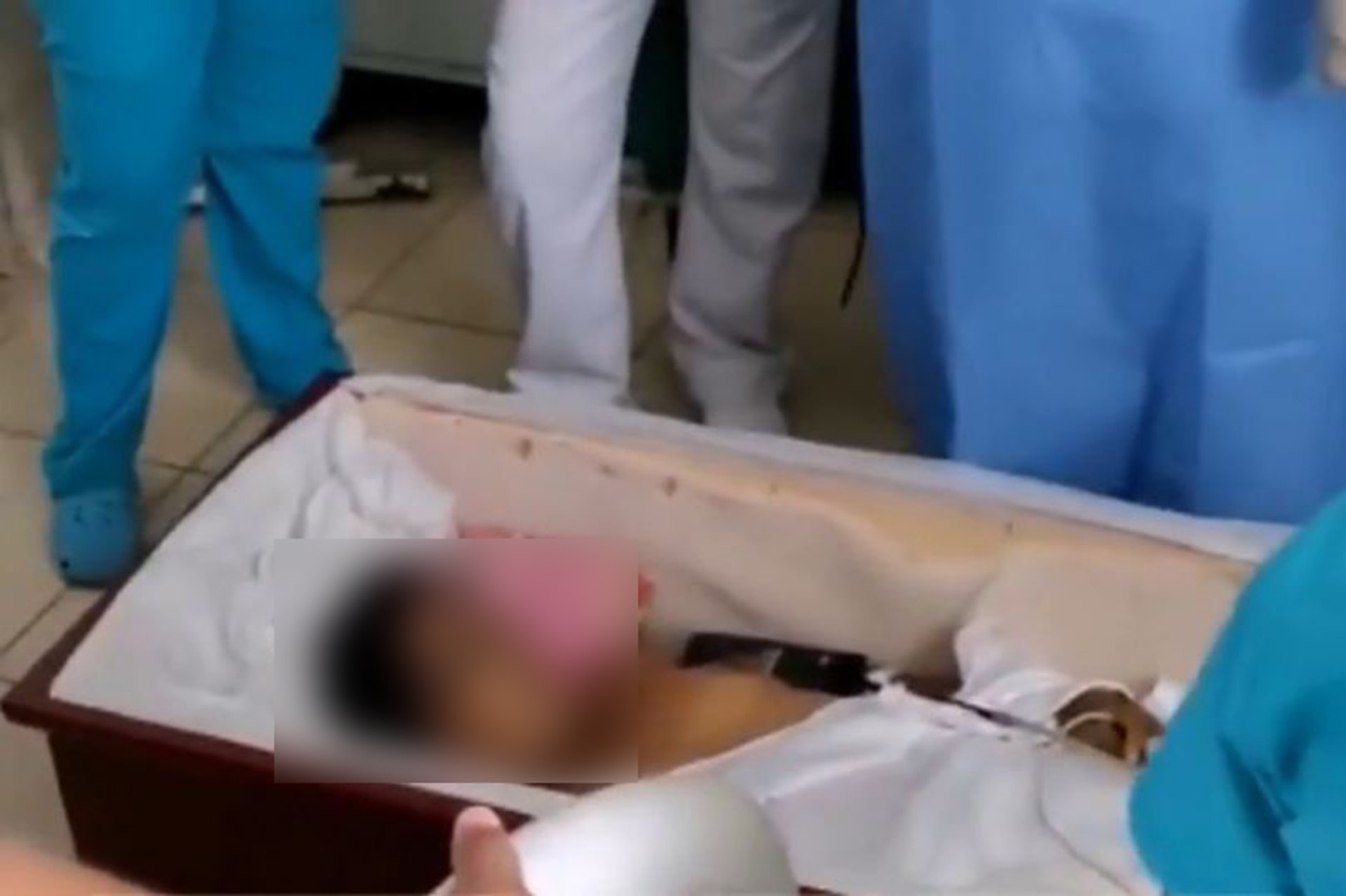 秘魯1名女子早前車禍「身亡」,卻在家人為她舉辦葬禮期間甦醒,被緊急送往醫院,可惜最終仍不治。(《ATV Noticias》YouTube影片截圖) 秘魯1名女子早前車禍「身亡」,卻在家人為她舉辦葬禮期間甦醒,被緊急送往醫院,可惜最終仍不治。(《ATV Noticias》YouTube影片截圖)