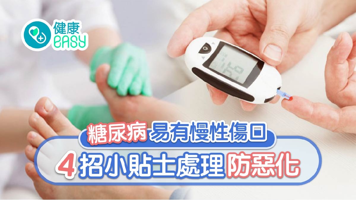 糖尿病|慢性傷口難癒合 腳部最高危 患者4大處理重點要知 糖尿病|慢性傷口難癒合 腳部最高危 患者4大處理重點要知