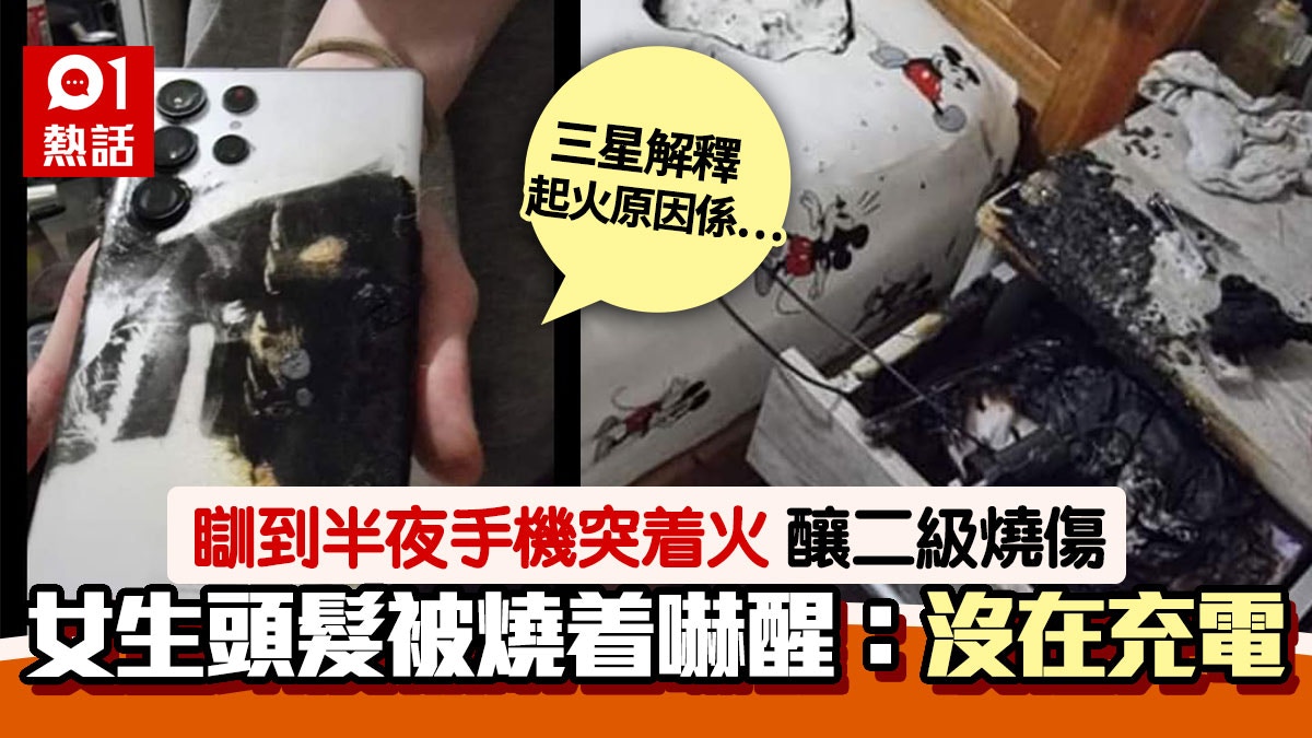 Samsung手機沒充電下自爆起火女生睡中遭二級燒傷三星咁回應 Samsung手機沒充電下自爆起火女生睡中遭二級燒傷三星咁回應