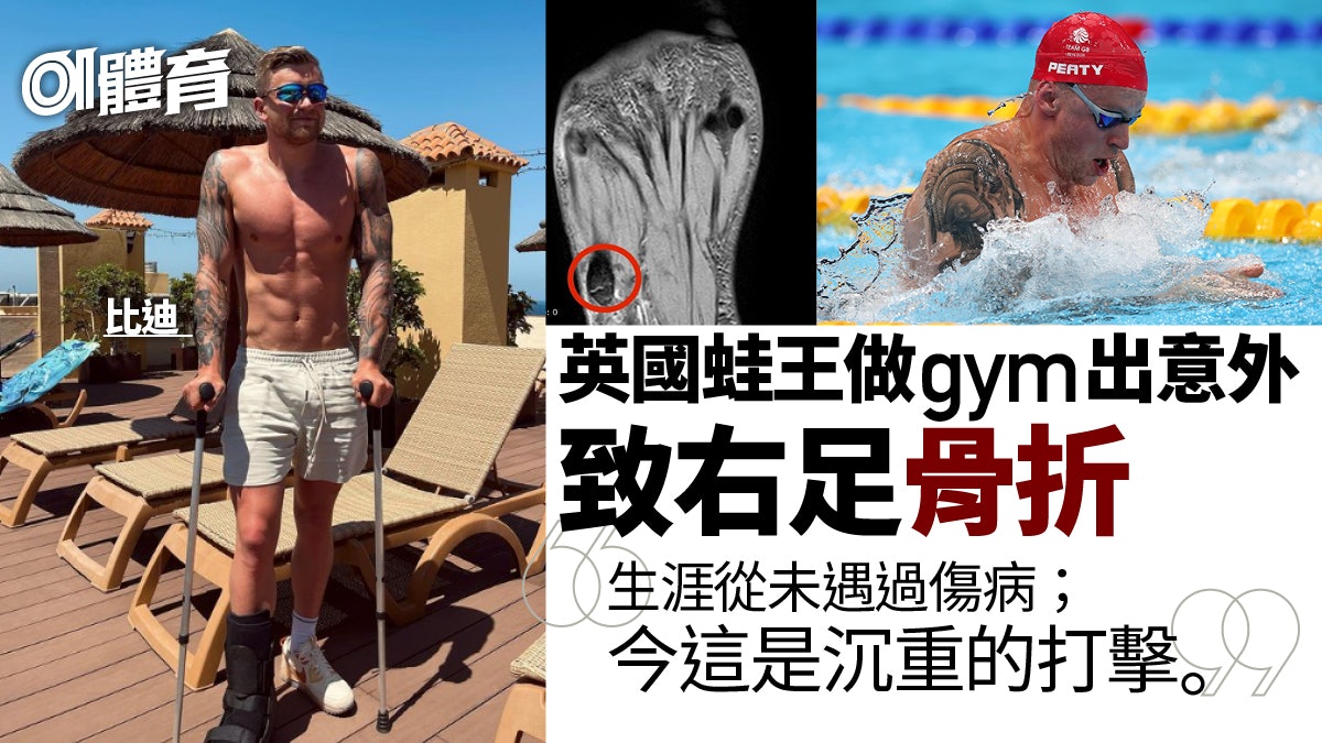 游泳 英國 蛙王 生涯首傷健身意外右足骨折無緣下月世錦賽 游泳 英國 蛙王 生涯首傷健身意外右足骨折無緣下月世錦賽