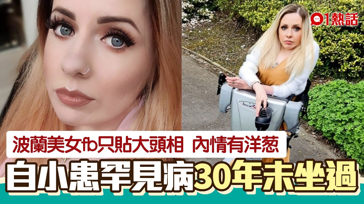 波蘭美女FB全是大頭照　原來患罕見病須用直立輪椅「30年未坐過」