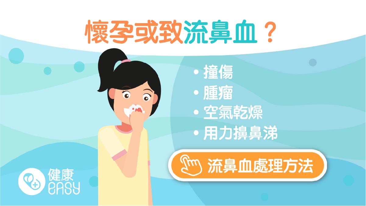 流鼻血 孕婦患妊娠性鼻炎鼻血流不停 醫生教止血正確處理方法