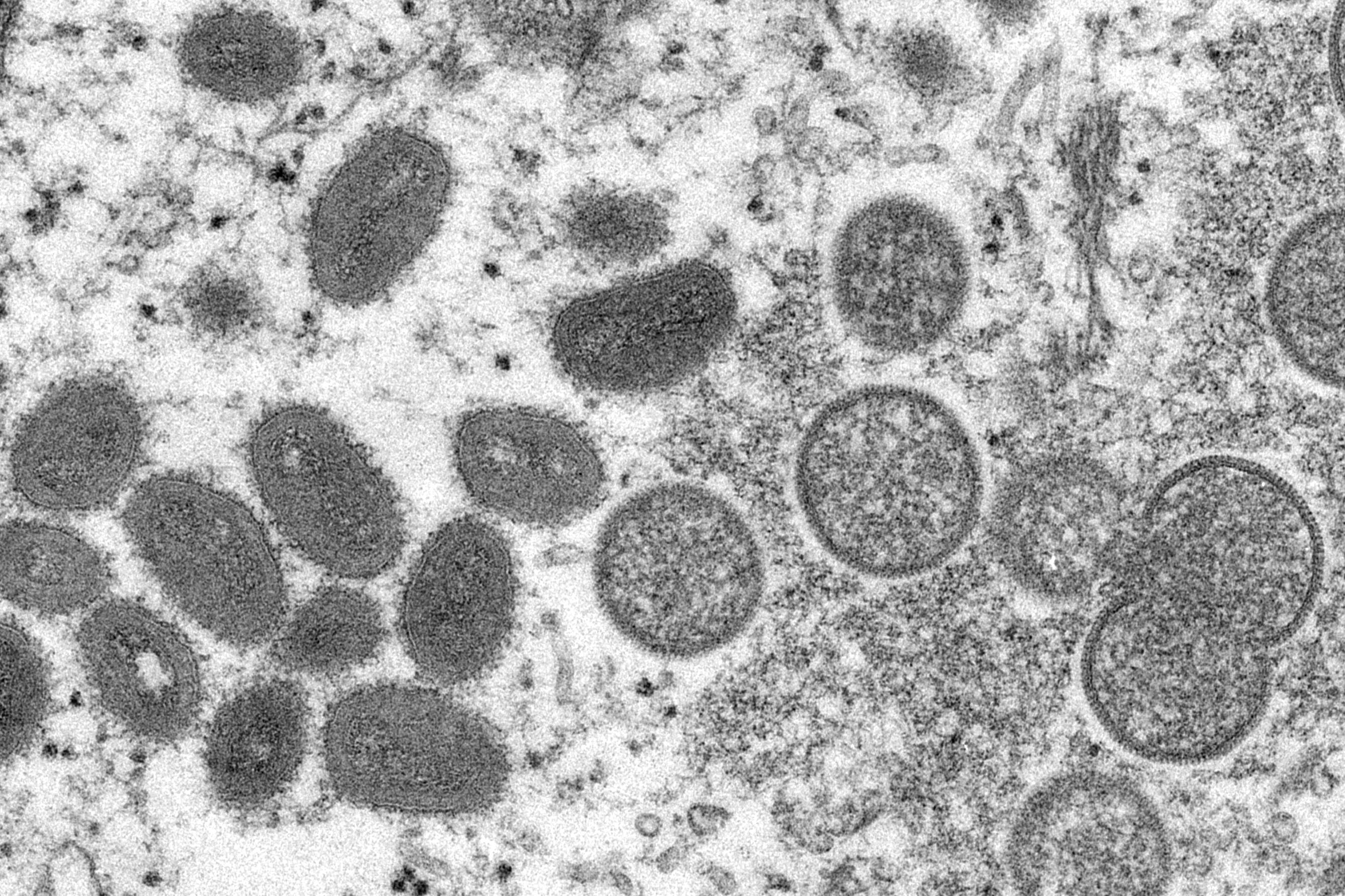 美国疾病控制和预防中心（CDC）在2003年提供的显微镜照片，左边为猴痘病毒。（AP）