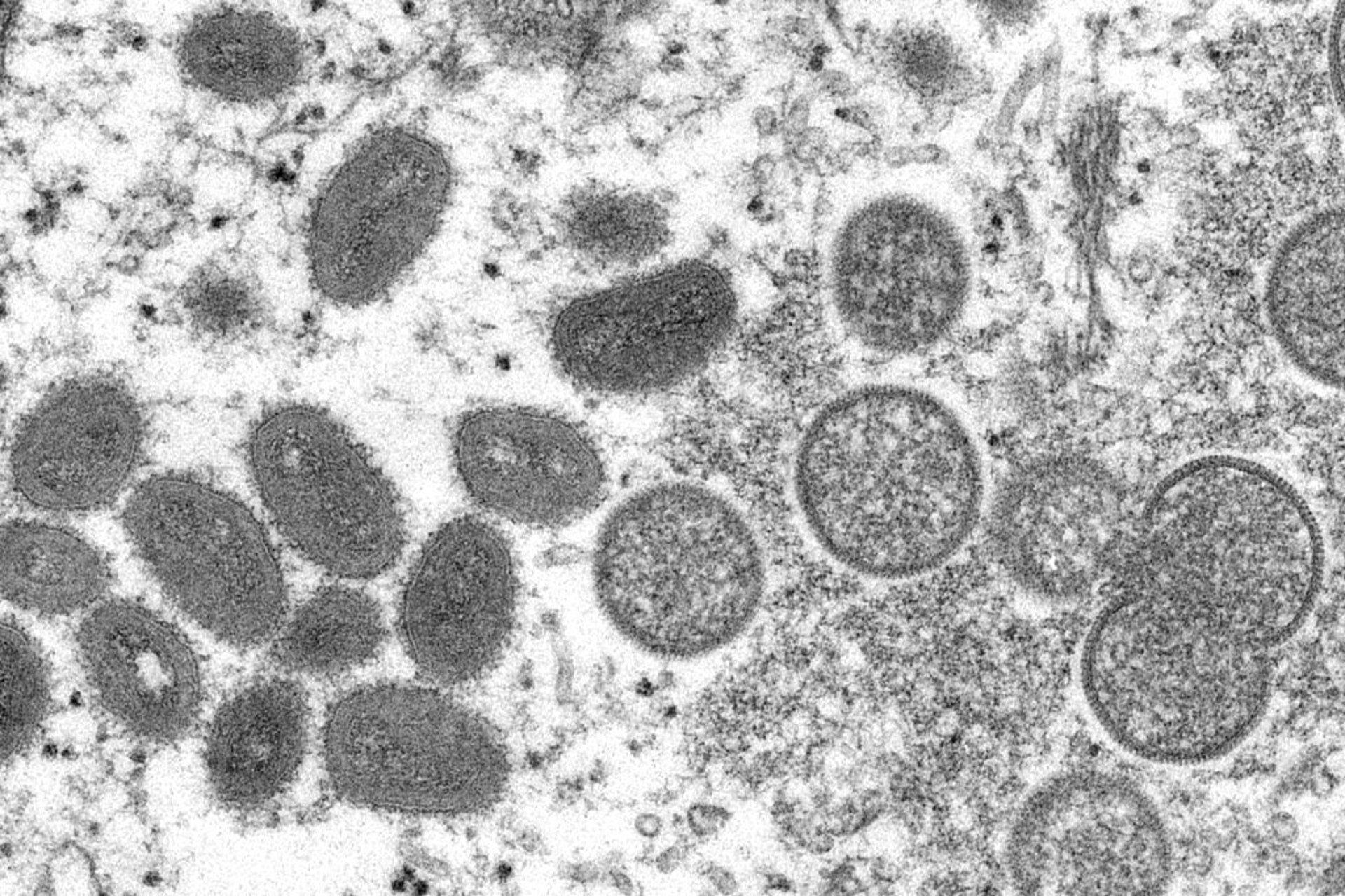 美國疾病控制和預防中心(CDC)提供的這張2003年電子顯微鏡圖像,顯示成熟的、橢圓形的猴痘病毒體(左)以及球形、未成熟病毒粒子(右),這是從與2003年草原犬鼠身上爆發猴痘疫情中、相關的人體皮膚樣本中獲得。(AP) 美國疾病控制和預防中心(CDC)提供的這張2003年電子顯微鏡圖像,顯示成熟的、橢圓形的猴痘病毒體(左)以及球形、未成熟病毒粒子(右),這是從與2003年草原犬鼠身上爆發猴痘疫情中、相關的人體皮膚樣本中獲得。(AP)