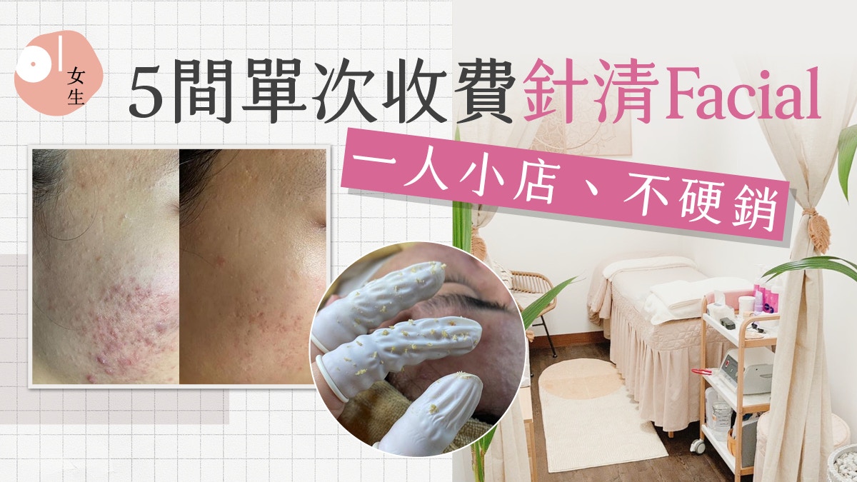 針清推介｜針清黑頭好唔好？尖沙咀單次收費　$4XX個人化療程