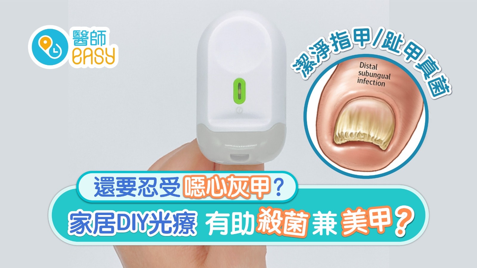 灰甲|變色增厚只能忍受?新式光療助殺菌 每日7分鐘改善灰甲改觀 灰甲|變色增厚只能忍受?新式光療助殺菌 每日7分鐘改善灰甲改觀