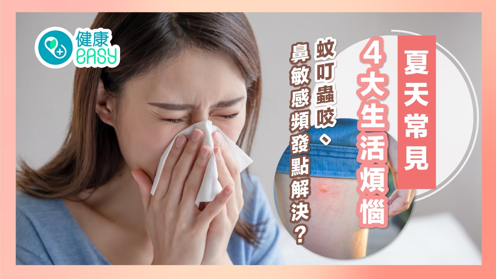 夏天|初夏常見4大生活煩惱 蚊叮蟲咬、鼻敏感頻發點解決? 夏天|初夏常見4大生活煩惱 蚊叮蟲咬、鼻敏感頻發點解決?