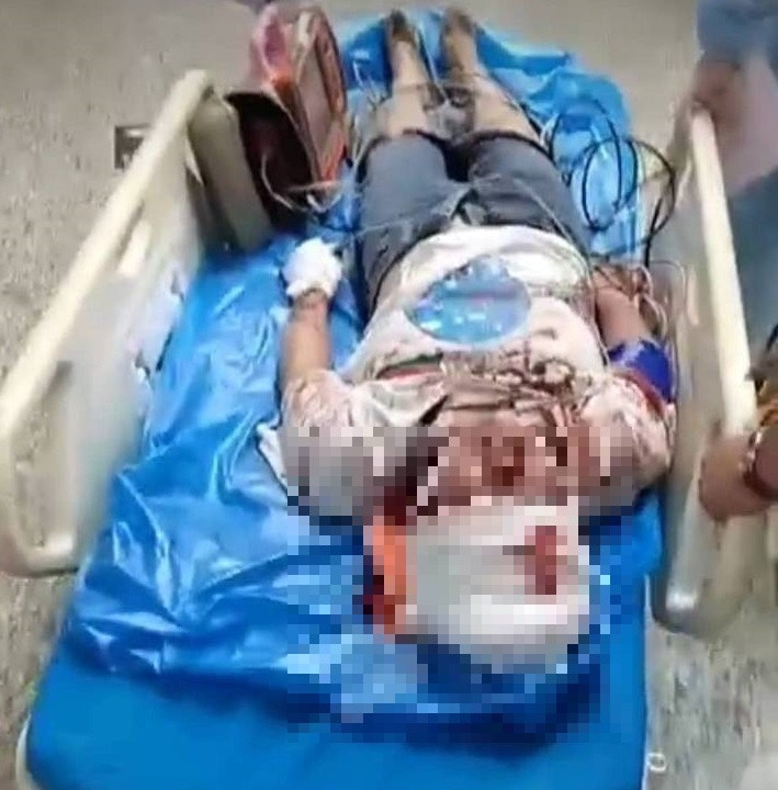 网传女子送医影片，头部受伤。（抖音）