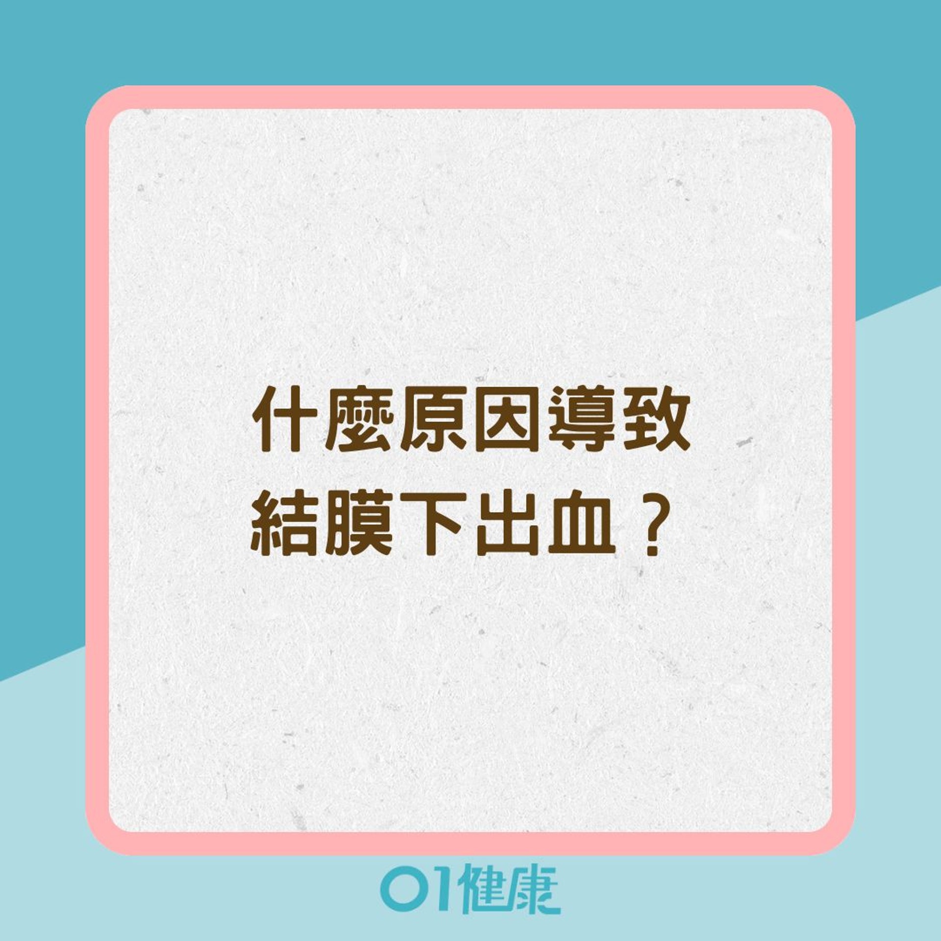 什麼原因導致結膜下出血?(01製圖) 什麼原因導致結膜下出血?(01製圖)
