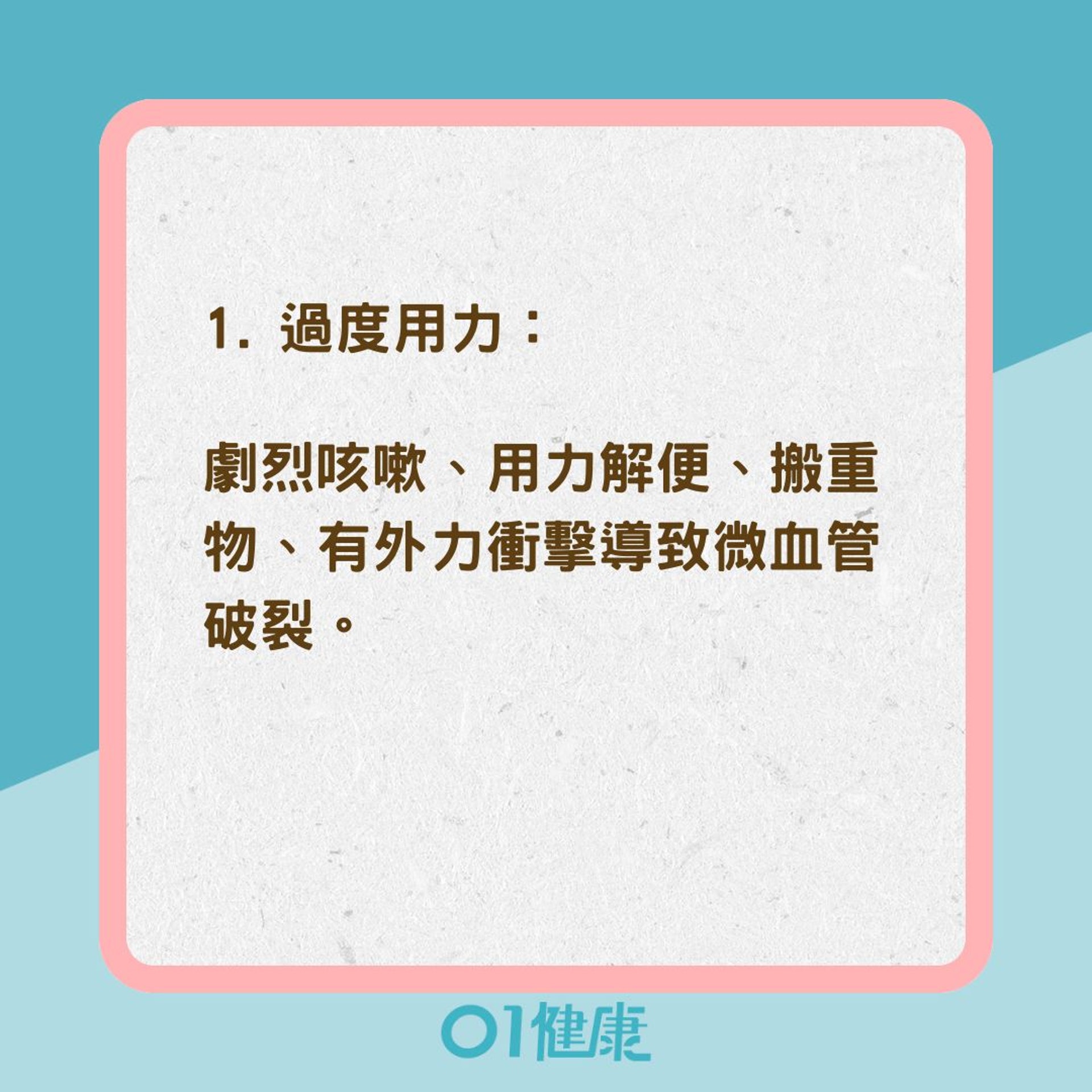 什麼原因導致結膜下出血?(01製圖) 什麼原因導致結膜下出血?(01製圖)