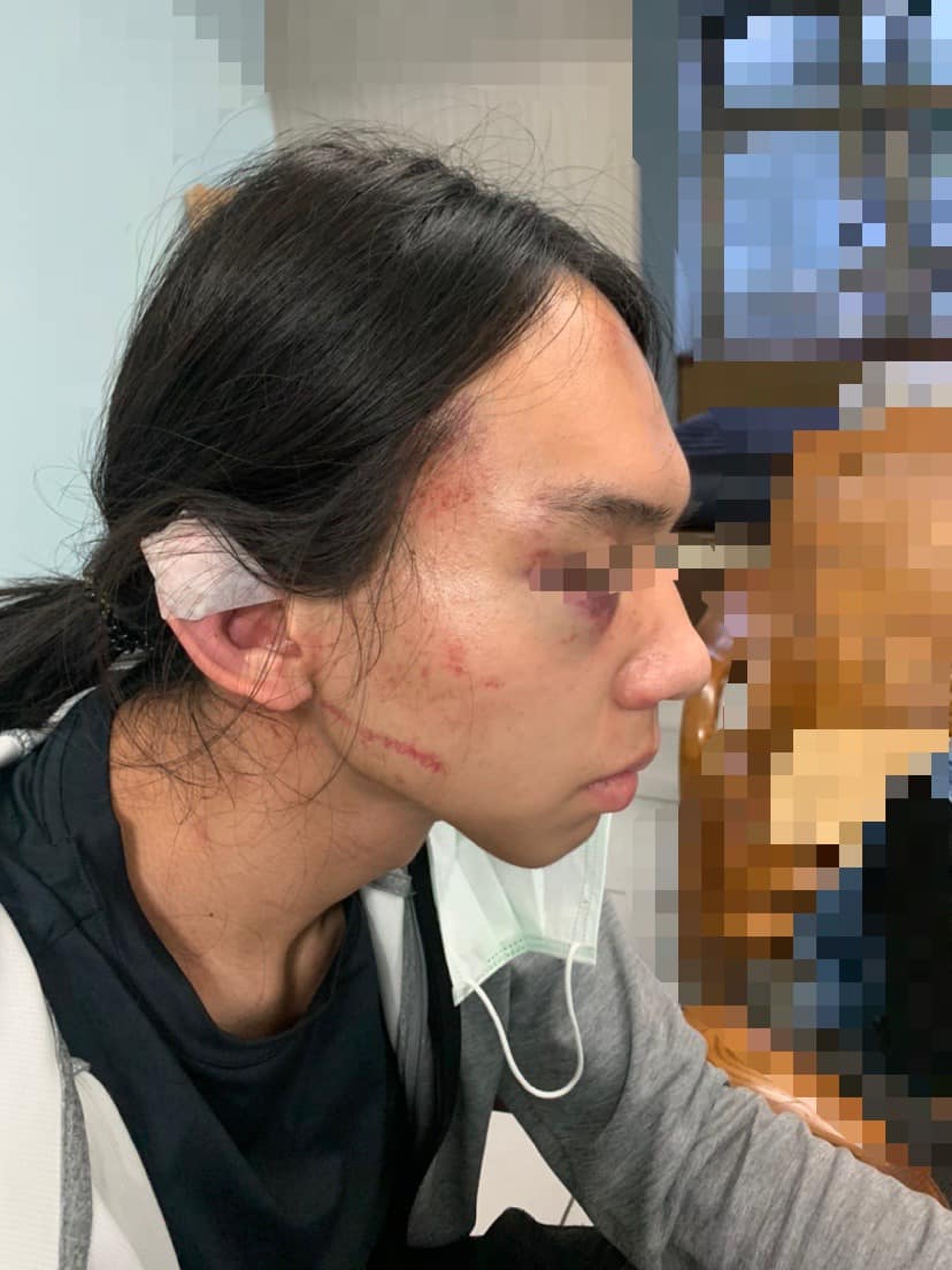 樓主的弟弟無故被流氓圍毆,警員到場時未有將他送院,而是先帶回警局,之後才上救護車。(fb群組「爆料公社二社」圖片) 樓主的弟弟無故被流氓圍毆,警員到場時未有將他送院,而是先帶回警局,之後才上救護車。(fb群組「爆料公社二社」圖片)