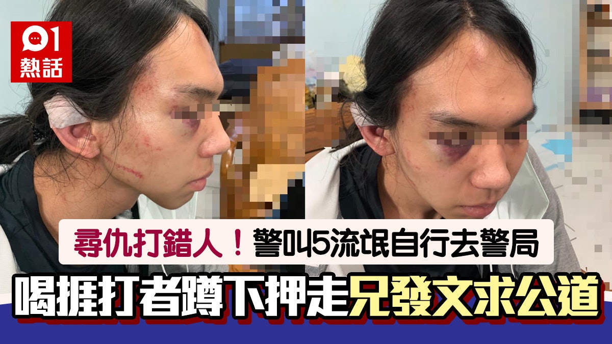 尋仇打錯人!警喝令被毆受害人蹲下押走 叫流氓自行到派出所惹議 尋仇打錯人!警喝令被毆受害人蹲下押走 叫流氓自行到派出所惹議