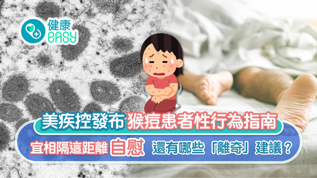 猴痘|連自慰距離也有要求?美疾控中心嚴防猴痘推「離奇」建議 猴痘|連自慰距離也有要求?美疾控中心嚴防猴痘推「離奇」建議