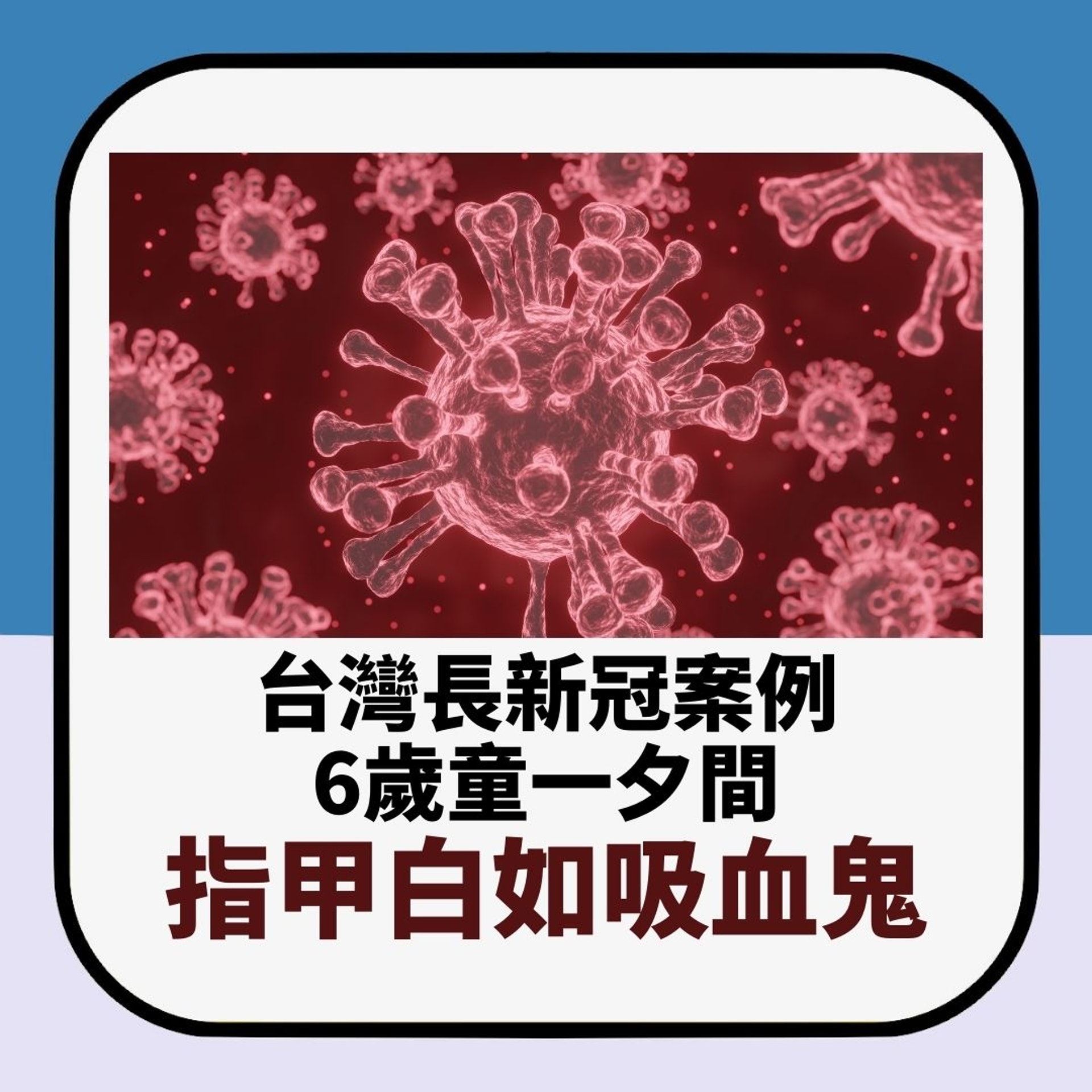 台灣長新冠案例 6歲童一夕間指甲白如吸血鬼(01製圖) 台灣長新冠案例 6歲童一夕間指甲白如吸血鬼(01製圖)