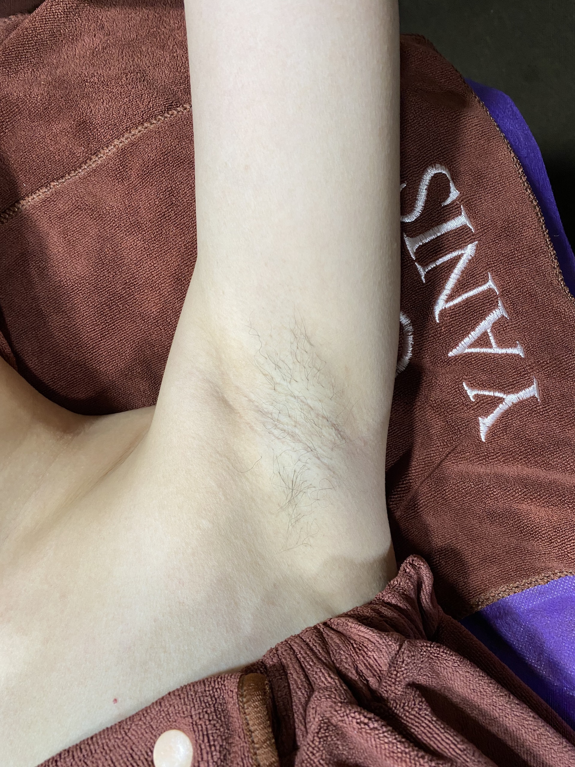然而不管身材多好,一旦皮膚表面有多餘又顯眼的毛髮,都會令外表大打折扣。(圖片:Yanis Beauty) 然而不管身材多好,一旦皮膚表面有多餘又顯眼的毛髮,都會令外表大打折扣。(圖片:Yanis Beauty)