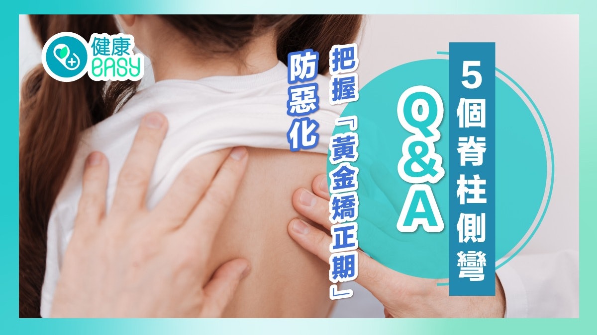 脊柱側彎|為你解答5個Q&A 把握「黃金矯正期」防惡化至心肺失調 脊柱側彎|為你解答5個Q&A 把握「黃金矯正期」防惡化至心肺失調