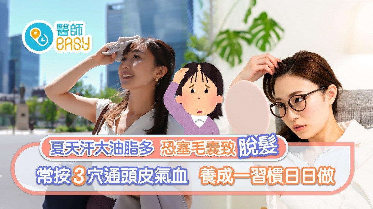 脫髮｜夏日大汗油脂多恐塞毛囊致脫髮　中醫教正確洗頭步驟護秀髮