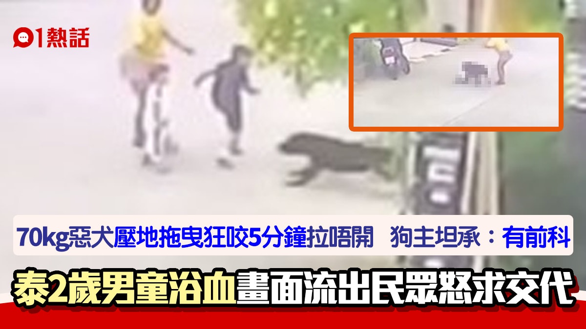 2歲男童遭比特犬狂咬頭面5分鐘縫200針 狗主承認咬人惡犬有前科 2歲男童遭比特犬狂咬頭面5分鐘縫200針 狗主承認咬人惡犬有前科