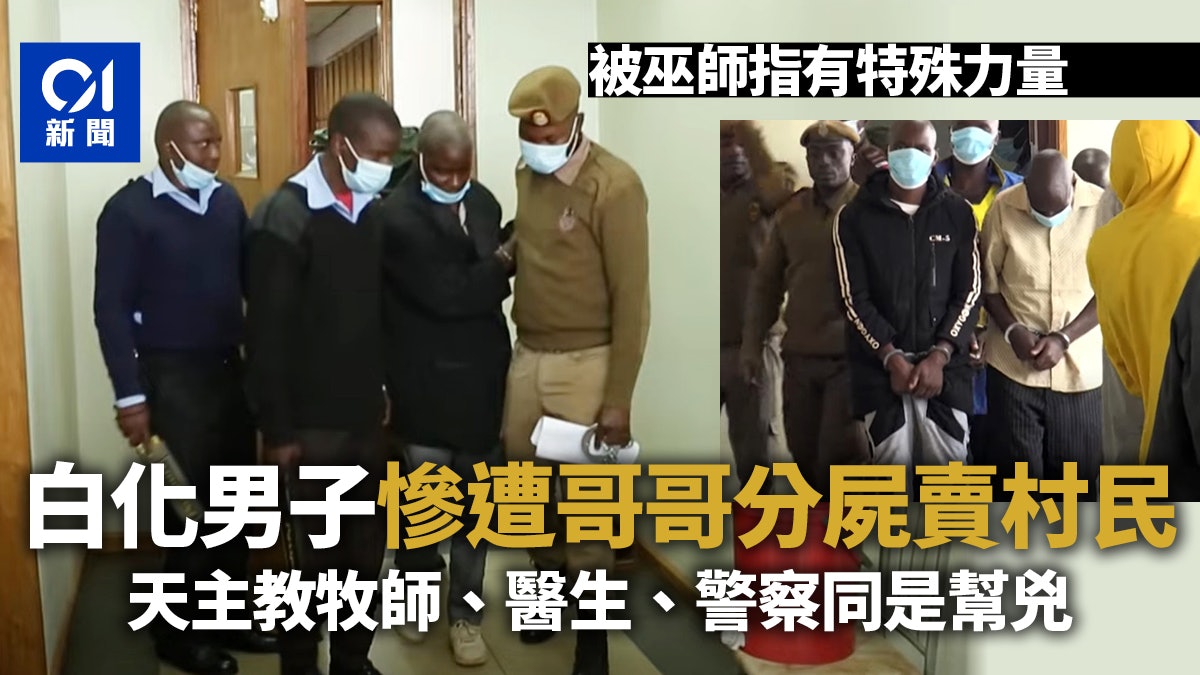 白化病患者「有價」 馬拉維男慘遭親哥哥分屍 當成幸運符出售 白化病患者「有價」 馬拉維男慘遭親哥哥分屍 當成幸運符出售