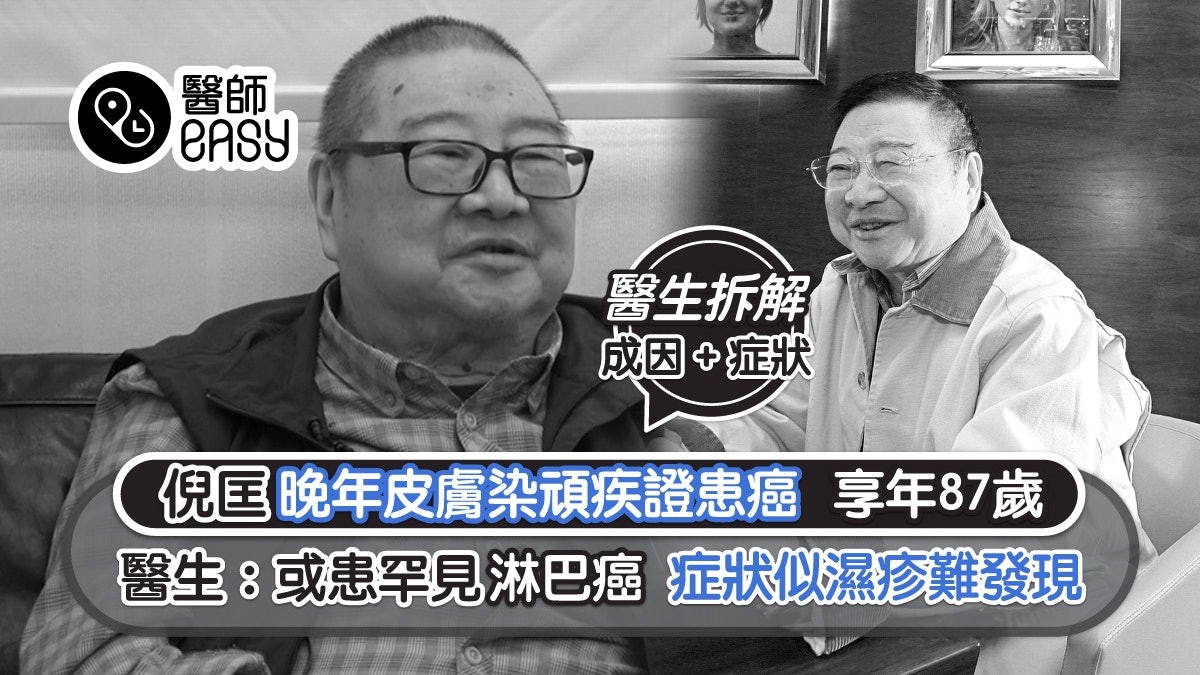 倪匡逝世|晚年皮膚染頑疾 醫生:或患罕見皮膚淋巴癌 症狀似濕疹 倪匡逝世|晚年皮膚染頑疾 醫生:或患罕見皮膚淋巴癌 症狀似濕疹