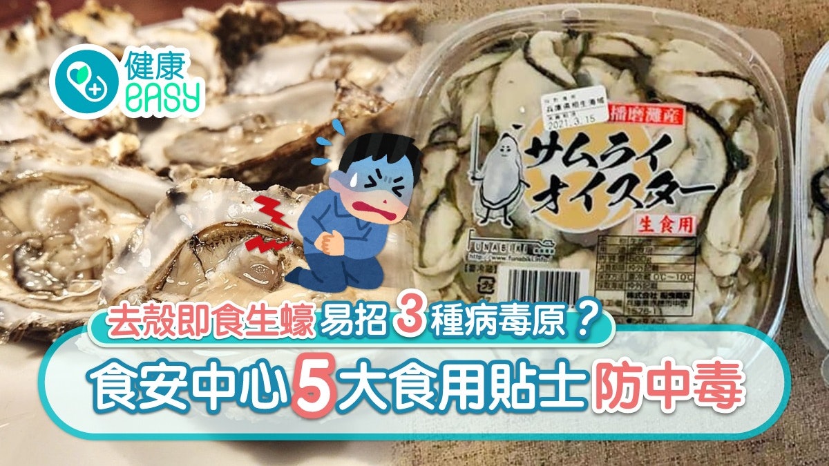 食物安全|去殻生蠔易惹病毒致腸胃炎?食安中心5大貼士避風險 食物安全|去殻生蠔易惹病毒致腸胃炎?食安中心5大貼士避風險