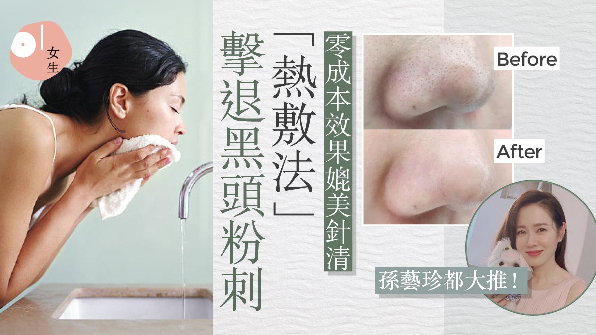 去黑頭粉刺零成本「熱敷法」孫藝珍大推!去黑頭後保濕即效果加倍 去黑頭粉刺零成本「熱敷法」孫藝珍大推!去黑頭後保濕即效果加倍