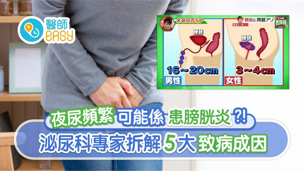 膀胱炎｜睇戲長途車唔急都小便易膀胱炎！5大成因小便幾秒最健康?