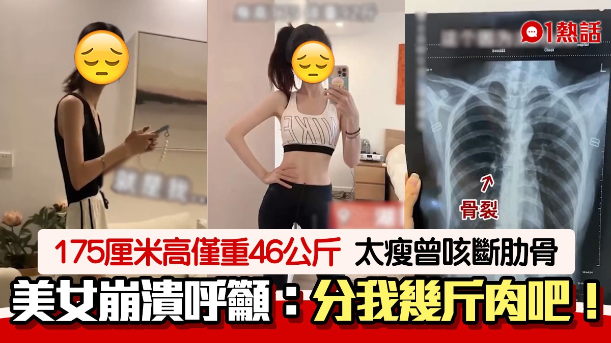 激瘦！175cm美女僅重46kg　呻太瘦的煩惱：咳斷肋骨、平板身材