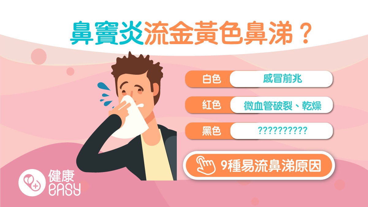 鼻涕顏色|黃色屬發炎白色則感冒前兆 6種鼻涕顏色反應身體狀況 鼻涕顏色|黃色屬發炎白色則感冒前兆 6種鼻涕顏色反應身體狀況