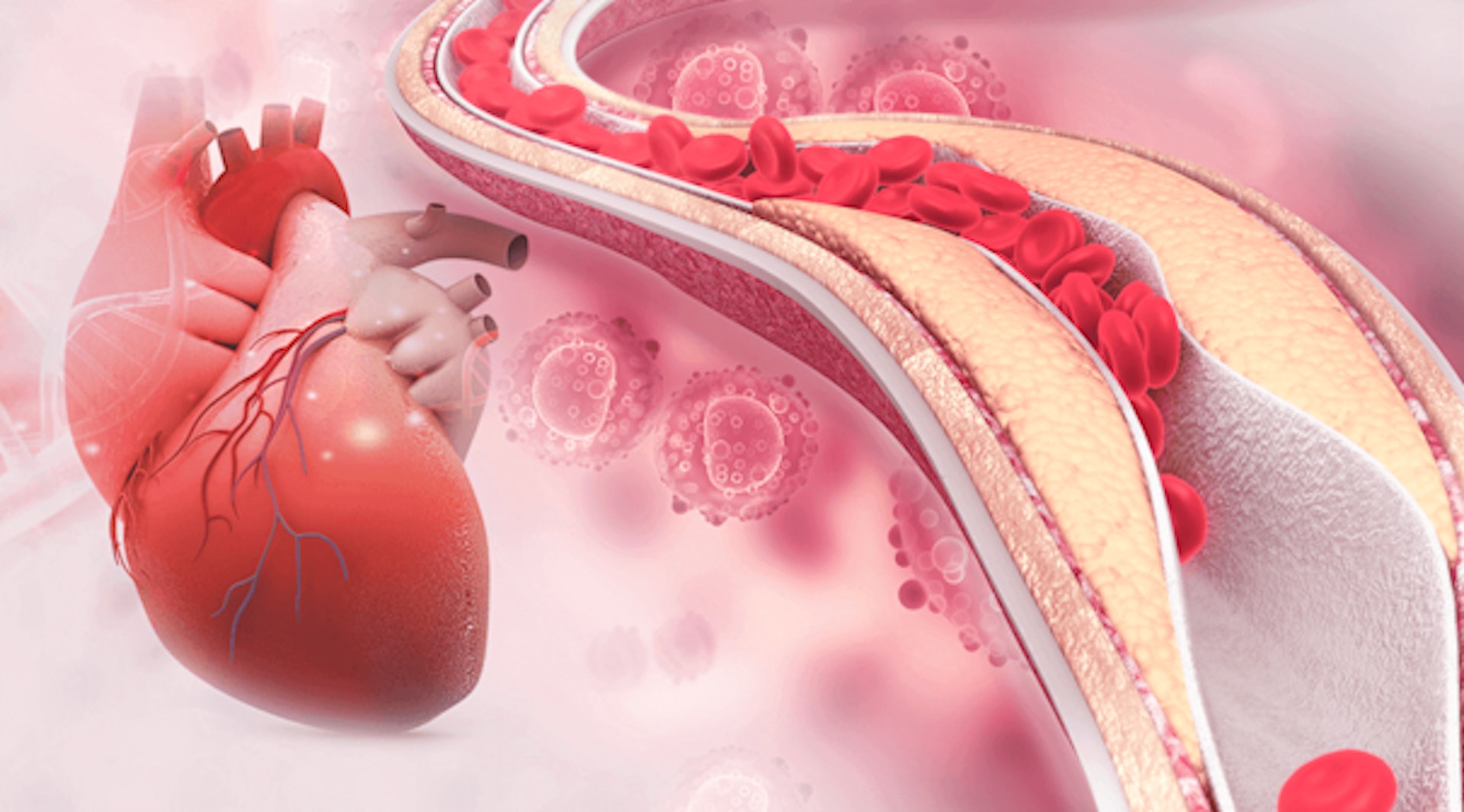 「家族性高膽固醇血症」患者一出生便有高膽固醇問題。（圖片：Shutterstock）