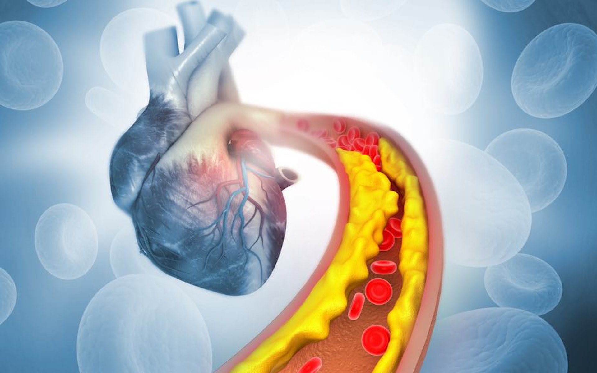 膽固醇會在血管累積，是心血管病的元兇之一，因此膽固醇問題絕對不容忽視。（圖片：Shutterstock）