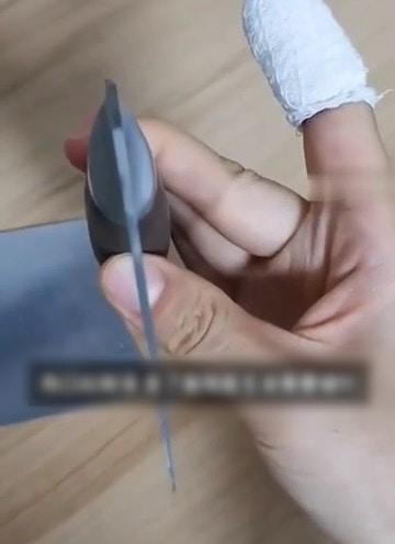 张小泉再爆拍蒜断刀！珠海女刀断割手指血溅满地，缝4针获赔417元（视频/组图） - 3