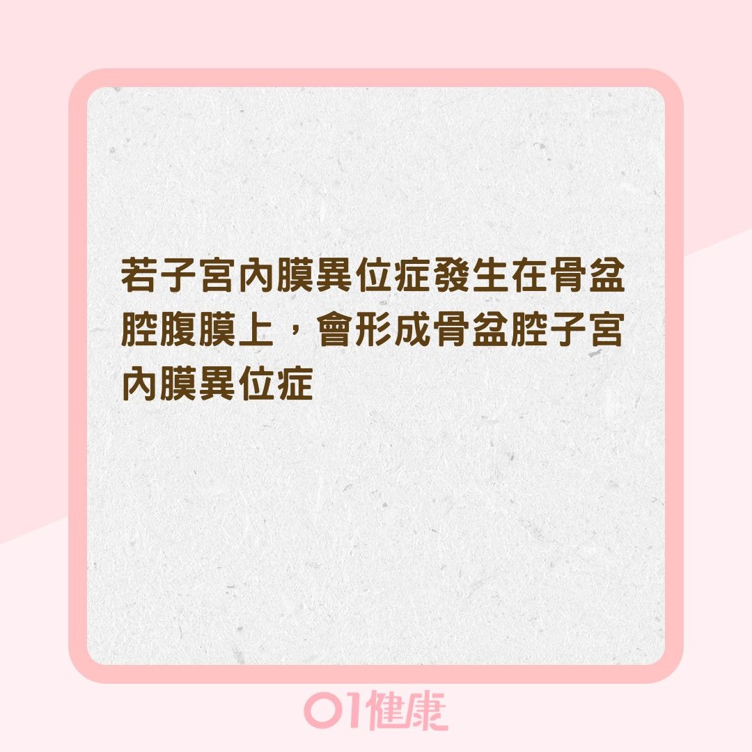 年紀愈大經痛愈嚴重是正常？（01製圖）