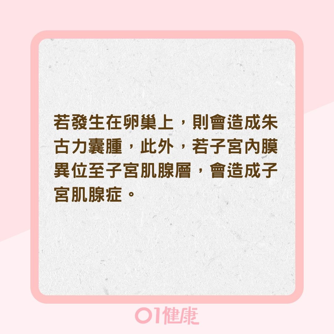 年紀愈大經痛愈嚴重是正常？（01製圖）