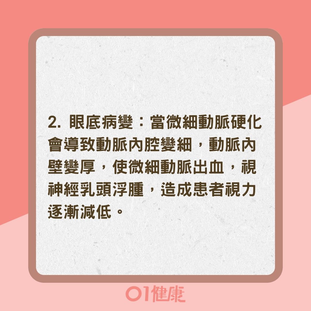 高血壓會引起哪些併發症？（01製圖）