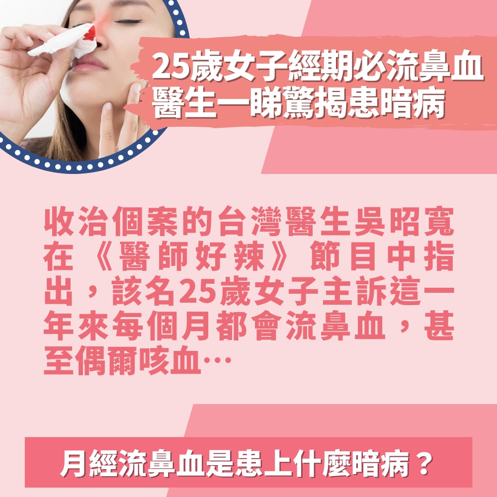 25歲女子經期必流鼻血「鼻中結血塊」醫生一睇驚揭患暗病：是經月（01製圖／Getty Images）