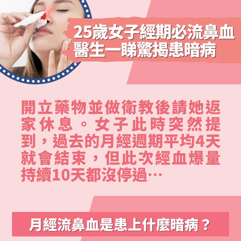 25歲女子經期必流鼻血 鼻中結血塊 醫生一睇驚揭患暗病 是經月