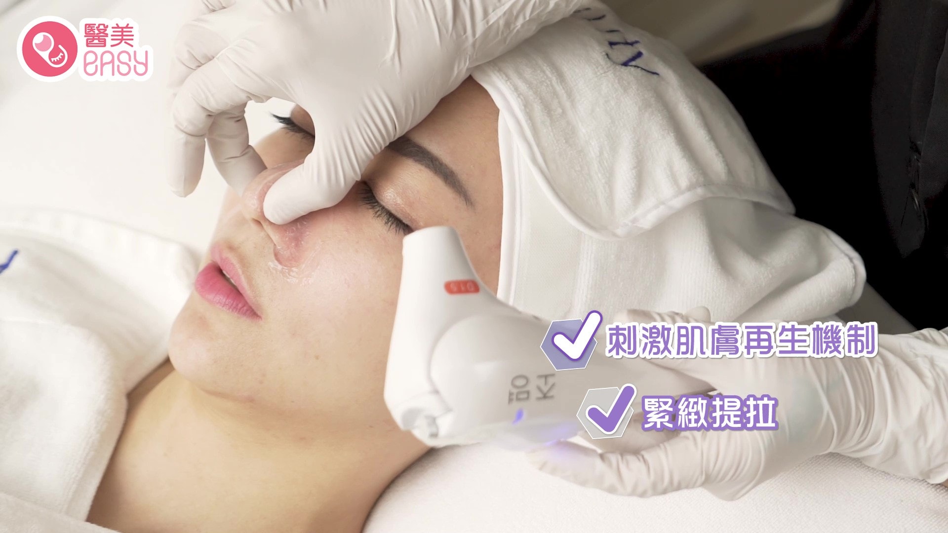 「韓式KF HIFU無創埋線」不但可減淡細紋,同時可刺激膠原蛋白增生,達到緊提拉提效果。(醫美Easy 製圖) 「韓式KF HIFU無創埋線」不但可減淡細紋,同時可刺激膠原蛋白增生,達到緊提拉提效果。(醫美Easy 製圖)