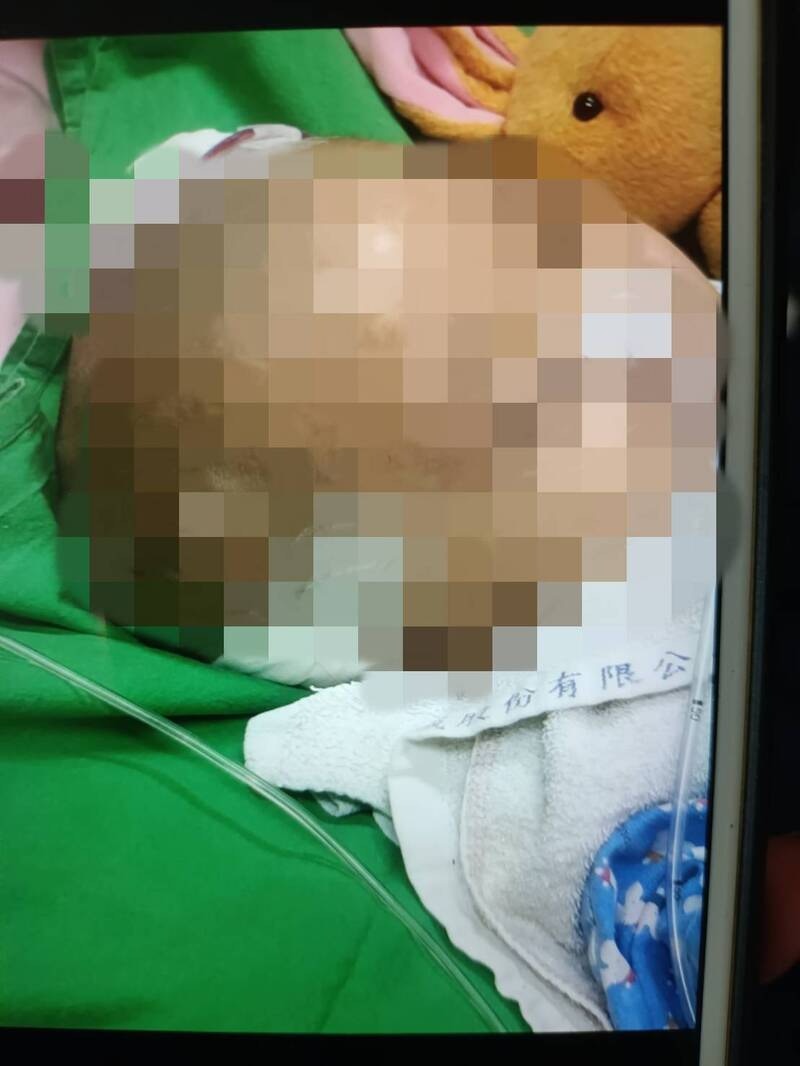 5歲大的蘇姓女童遭毒打、逼喝尿、舔糞便穢物、抓腳倒頭旋轉等,導致半邊癱瘓、右眼失明、左眼視力亦僅剩些許。(網上圖片) 5歲大的蘇姓女童遭毒打、逼喝尿、舔糞便穢物、抓腳倒頭旋轉等,導致半邊癱瘓、右眼失明、左眼視力亦僅剩些許。(網上圖片)