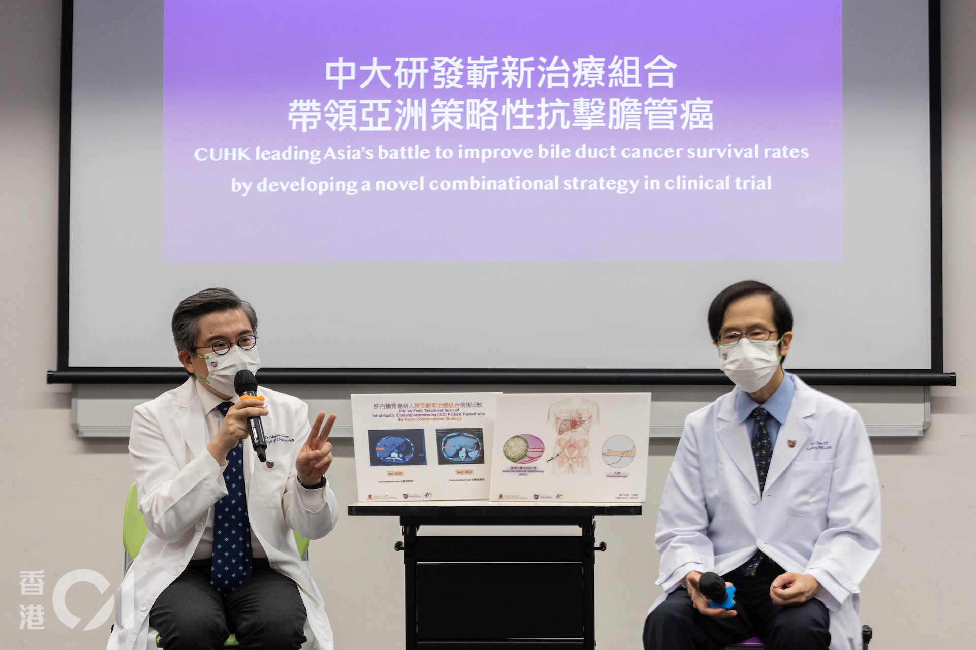 中文大學醫學院牽頭的一項研究發現，若將選擇性體內放射治療（SIRT）與標準化療結合，可有效治療不適合經手術切除的肝內膽管癌。（梁鵬威攝）
