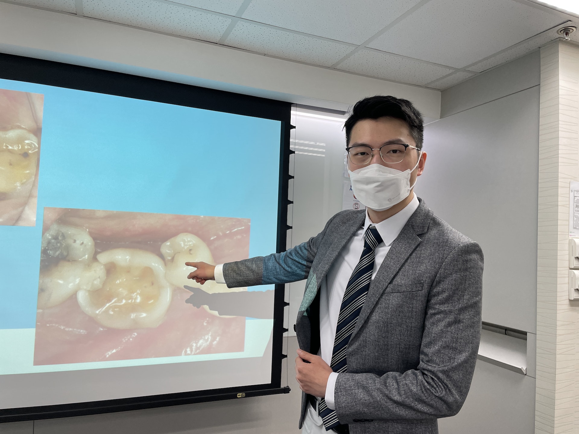 牙科醫生黃凌旻醫生講解牙齒侵蝕。 牙科醫生黃凌旻醫生講解牙齒侵蝕。