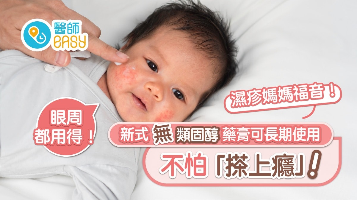 濕疹|用類固醇會「搽上癮」?民間偏方、新式無類固醇藥膏有效? 濕疹|用類固醇會「搽上癮」?民間偏方、新式無類固醇藥膏有效?